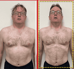 Mike before and after
